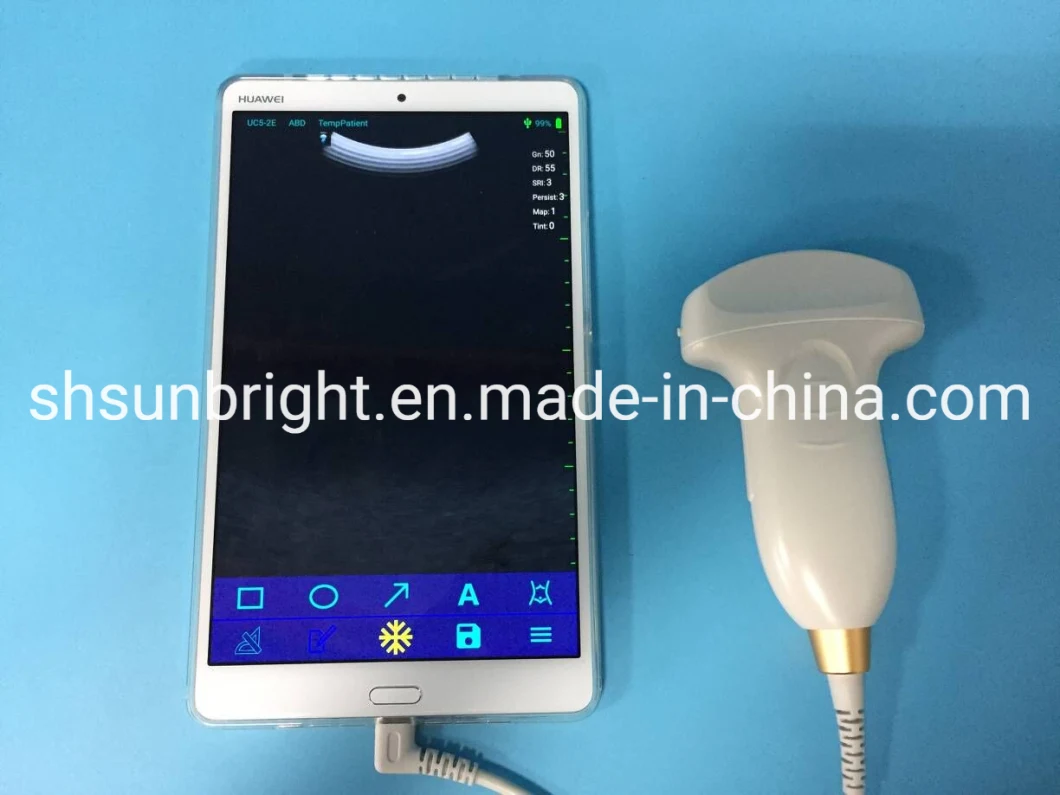 USB Convex Probe Sun-P1 Ultrasonido Ecografos De Portatil Ultrasonido Veterinario Portatil