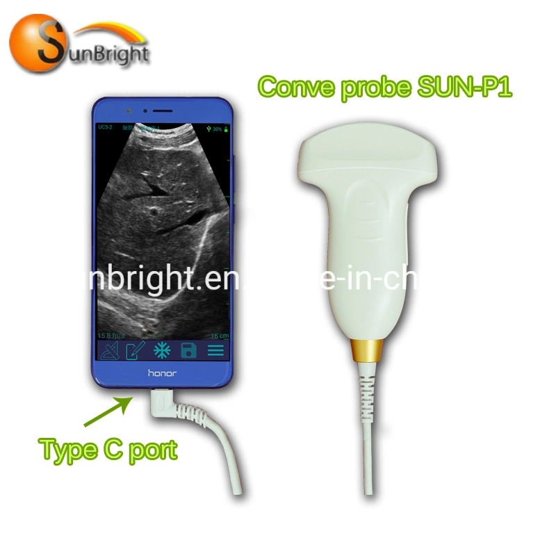 USB Convex Probe Sun-P1 Ultrasonido Ecografos De Portatil Ultrasonido Veterinario Portatil